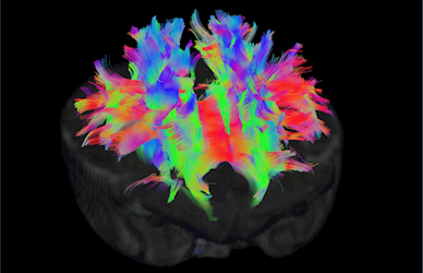 structural connectivity in a neonatal brain