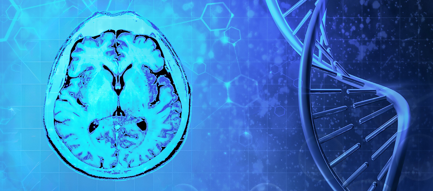 A brain scan