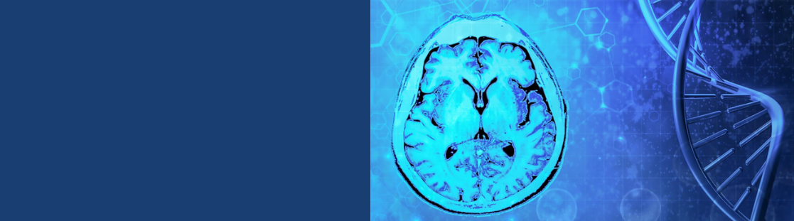 A brain scan
